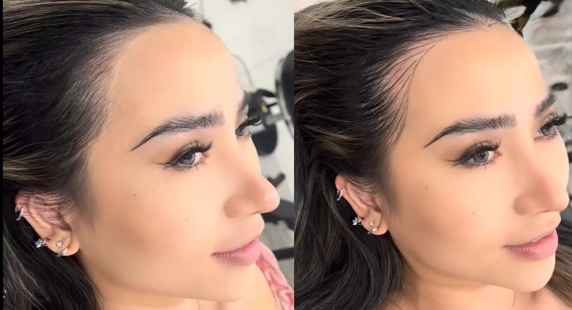 SMP Consultation w/ Hairline Focus, Density Boost for Hair Loss w/Care