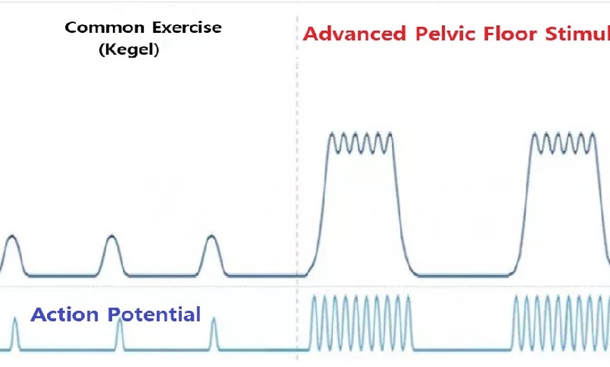 Image 6: Advanced Men’s Pelvic Floor Therapy for Pelvic Pain & Problems