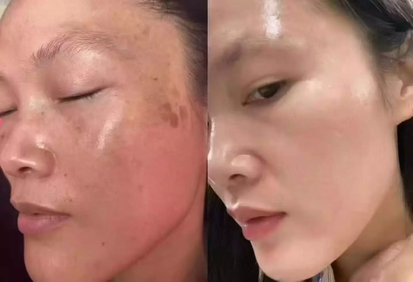 Up to 60% Off on HydraFacial at Magic Beauty Wellness - Primary Image