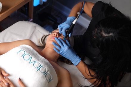 One HydraFacial® Signature (45 minutes) - NovaPiel Med Spa