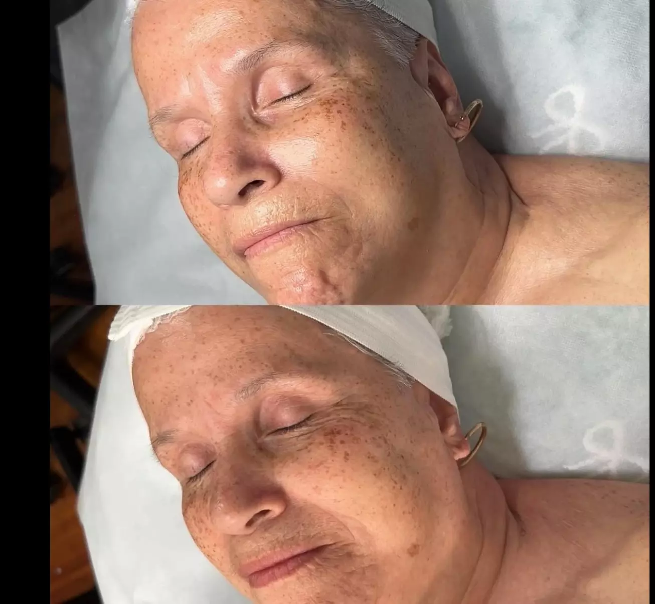 Experience Smoothness with Dermaplaning or Fall Special Custom Facial!