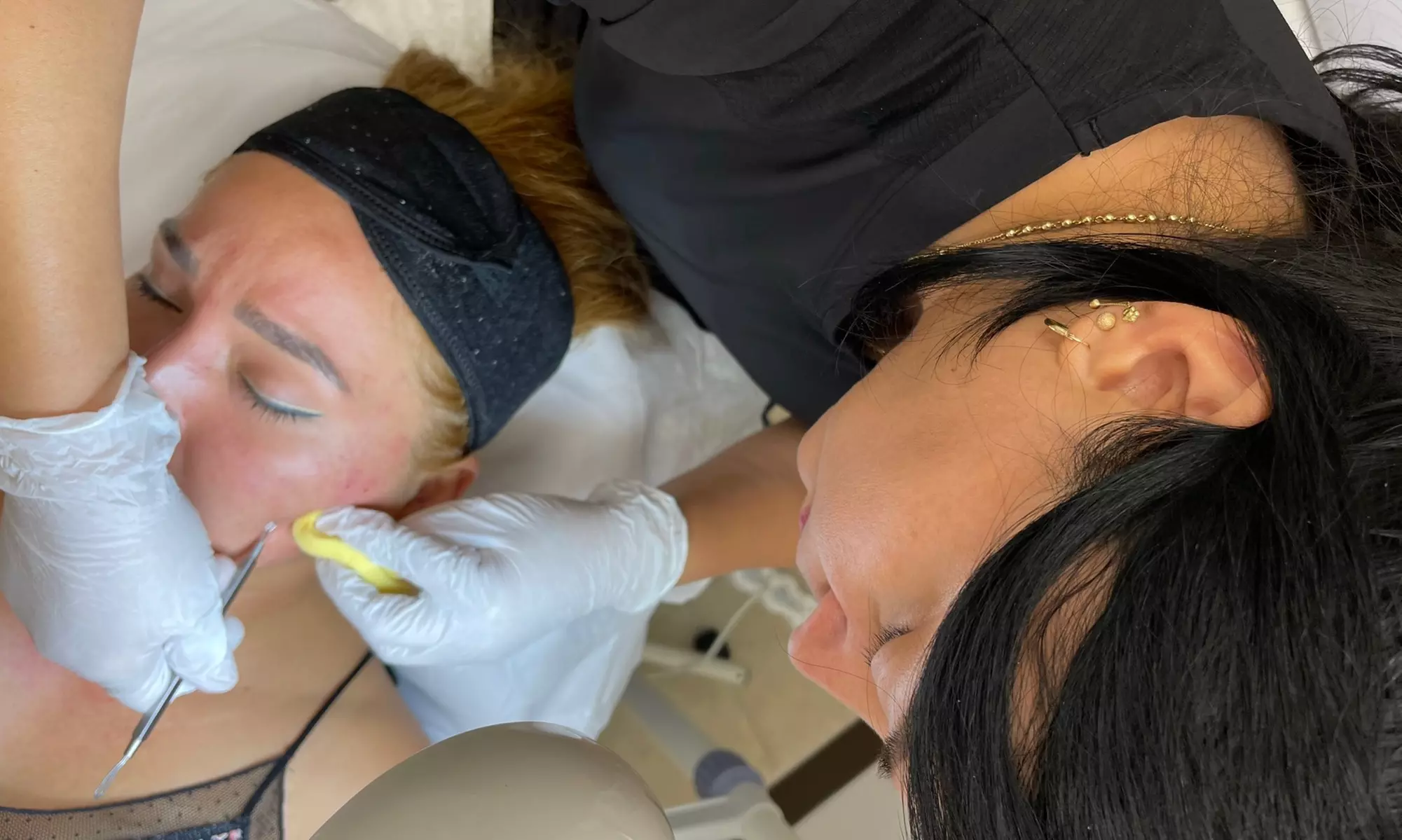 Clear Skin Journey: Acne Treatment Sessions to Transform Your Skin