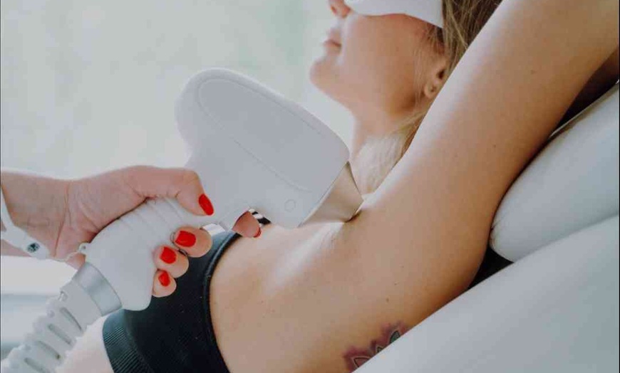 Image 1: Up to 65% Off on Laser Hair Removal at Your Designed Body_llc