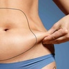 Image 1: Cryolipolysis Fat Freezing on Two Areas at Vibration Cafe