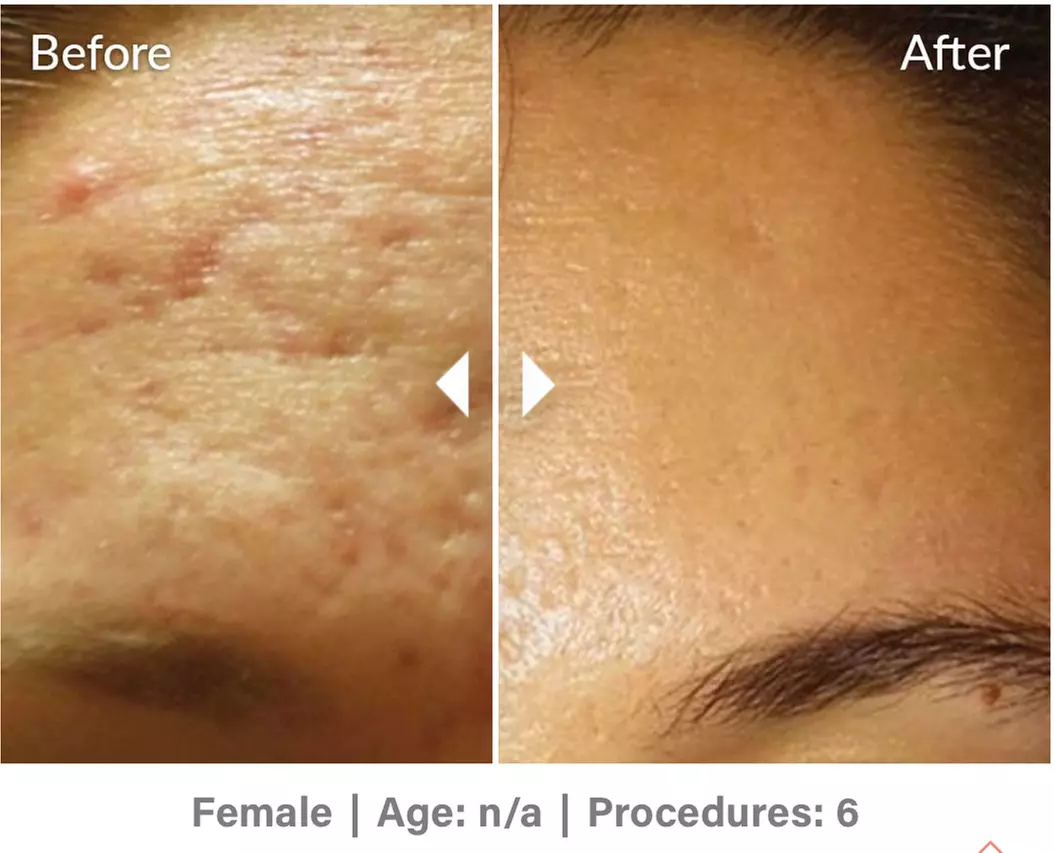 Up to 49% Off on Spa/Salon Beauty Treatments (Services)