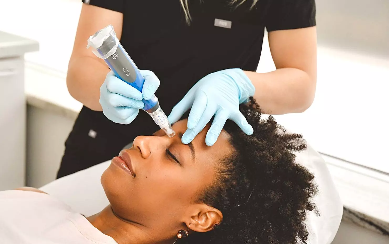 Up to 71% Off on Micro-Needling at Loma Laser