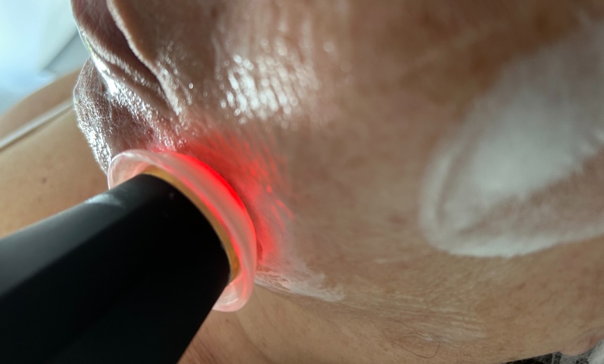 Image 2: Soin du visage Oxyderm : éclat et oxygénation
