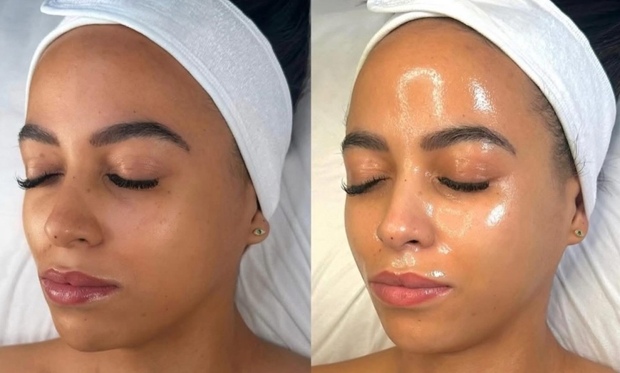 Image 8: Revitalize Your Skin with upto Three 90-minute Hydrafacials Sessions