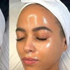 Image 8: Revitalize Your Skin with upto Three 90-minute Hydrafacials Sessions