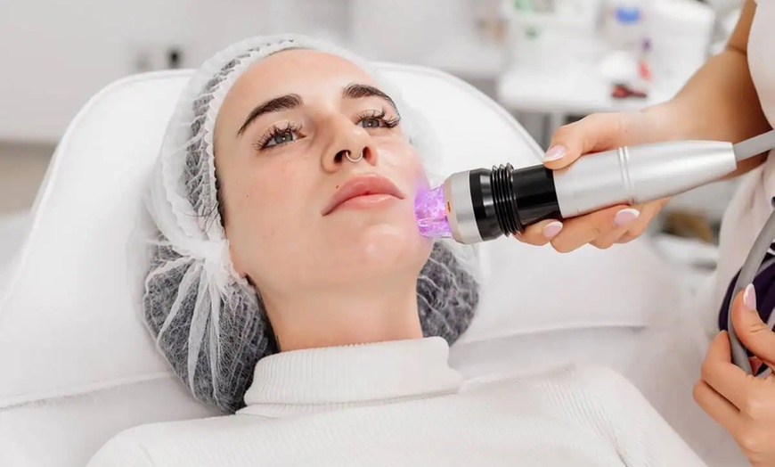 Image 3: Get Facial Package with Microneedling, Signature, Chemical Peel & More