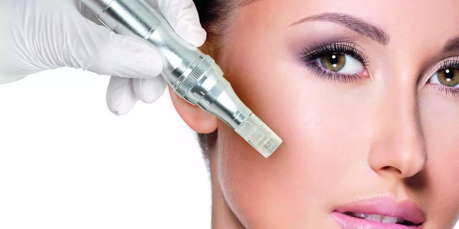 Experience rejuvenation at Fountain Hills Med Spa with micro-needling sessions, offering up to 54% off for youthful skin - Primary Image