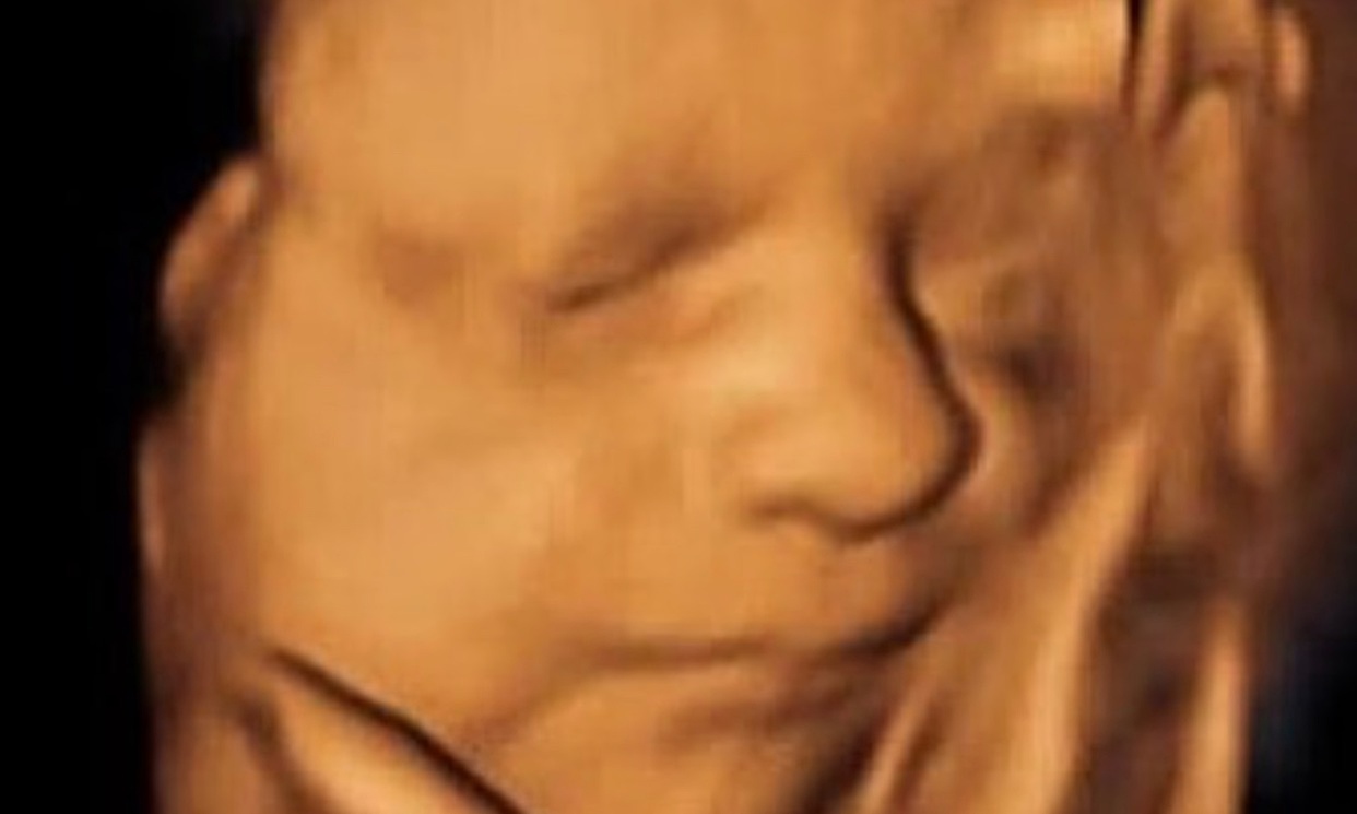 Up to 80% Off on Ultrasound - 3D / 4D at 5D ULTRASOUND STUDIO