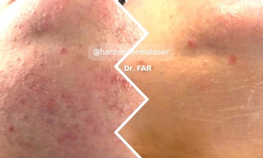 Image 2: 45-75 Min. After Holiday Glow & Serum-Therapie