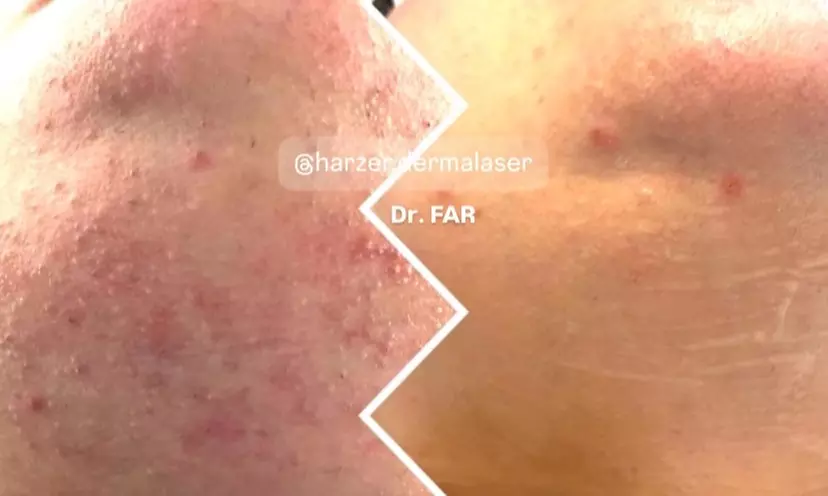 45-65 Min. After Holiday Glow & Serum-Therapie