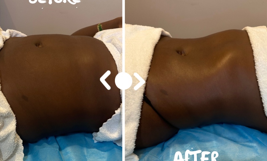 Image 3: Up to 55% Off on Cavitation at Enchanted Curves @ Zenfultouch