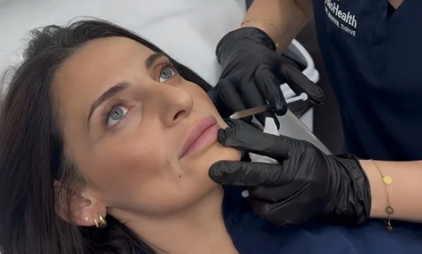 Image 1: Revitalize w/ 1,2,or 3 Sessions of PRP Full Face Includes Under eyes 