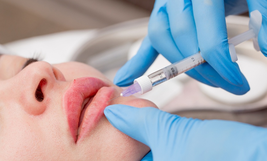 Image 5: Up to 25% Off on Injection - Dermal Filler at My Aesthetic Lounge