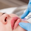 Image 5: Up to 25% Off on Injection - Dermal Filler at My Aesthetic Lounge