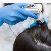 Image 1: 1-Hour Hair & Scalp Consultation with Analysis Valid Monday - Saturday