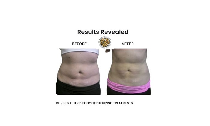 Image 2: One 30 Minutes or 1 Hour Venus Legacy Face or Body Sculpting Session