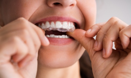 Invisible Aligners - Top or Bottom Arch (6 Aligners) - AMC Dental