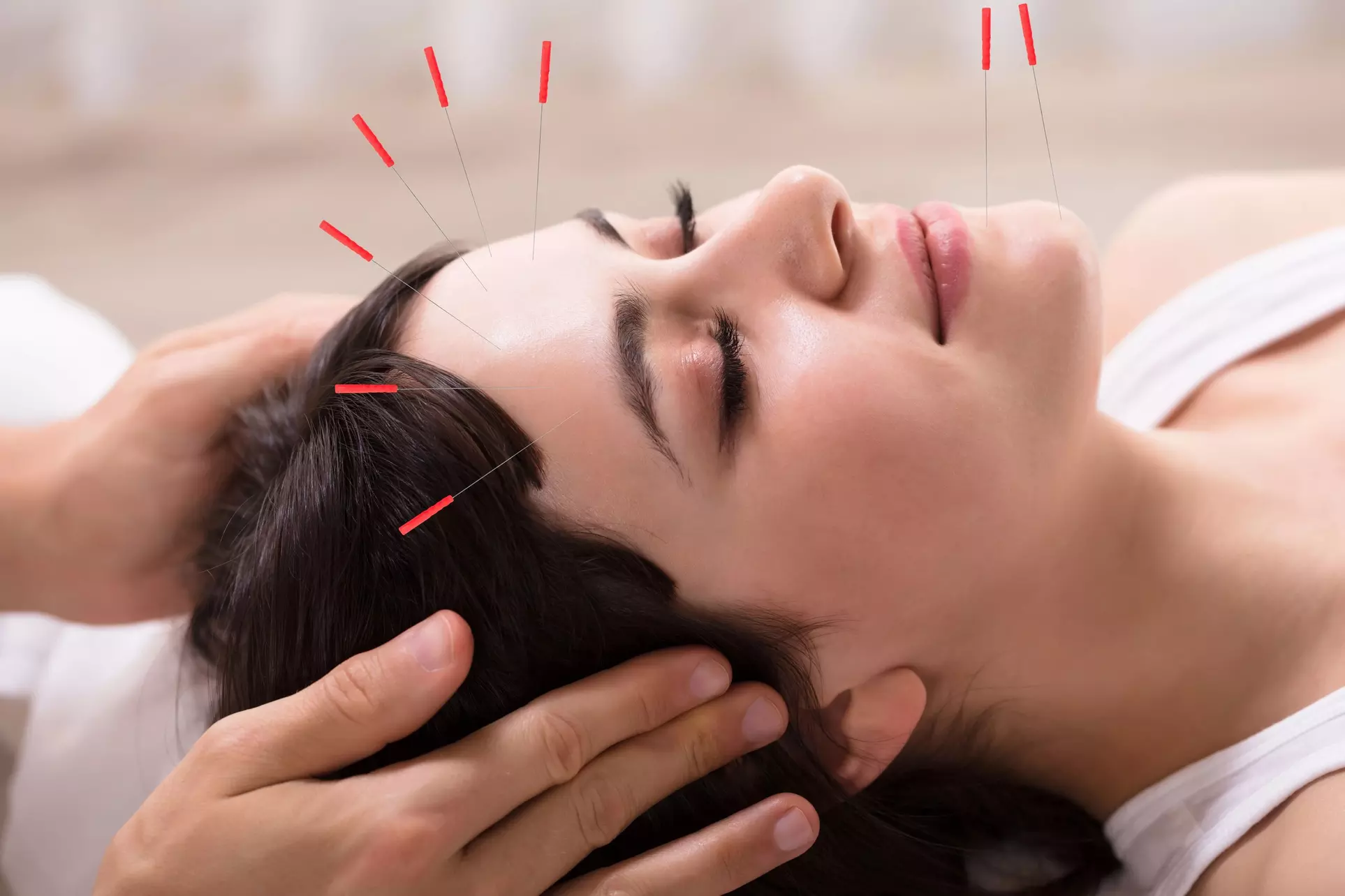 Holistic Healing with Acupuncture or Fire Cupping + Biofeedback