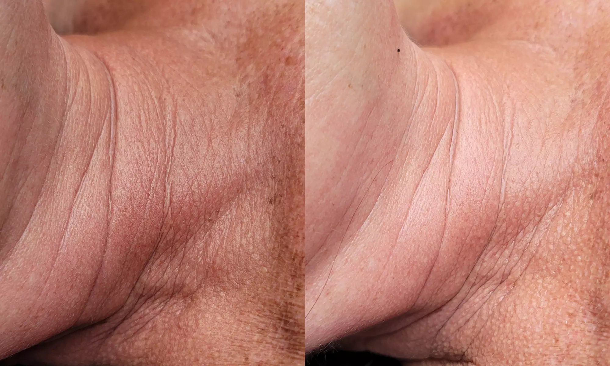 Spa Gift Certificates for Relaxing Massage & Facial Treatments