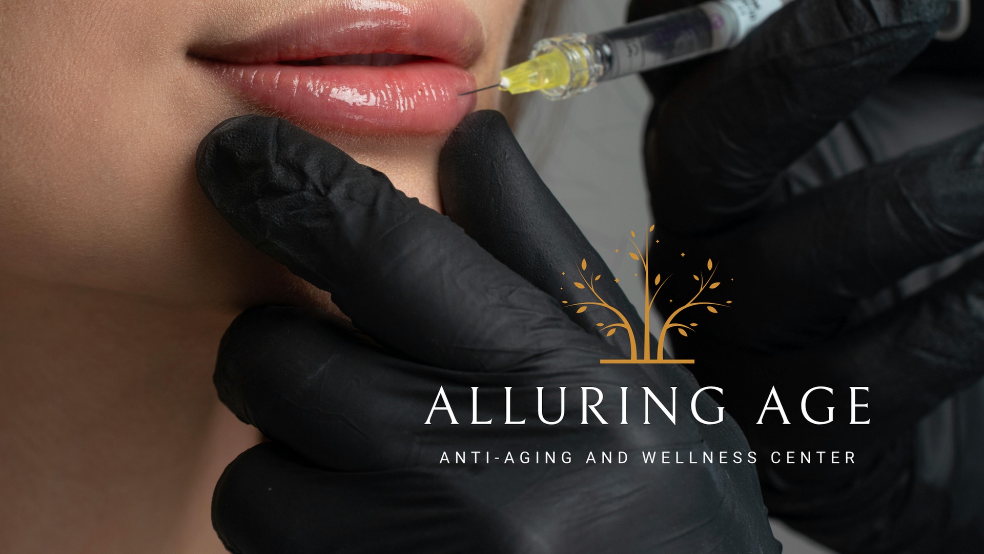 One Full Syringe Lip Filler With Laser Enhancement For Lasting Results