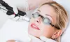 Smooth Skin w/ 3 or 6 Laser Hair Removal Sessions for a Small or Medium Areas @ NU Age Aesthetics 9Up to 50%Off)