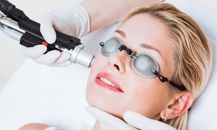 Three Laser Hair Removal Sessions for a Small Area (E.g. Upper Lips, Chin, Areola) - NU Age Aesthetics