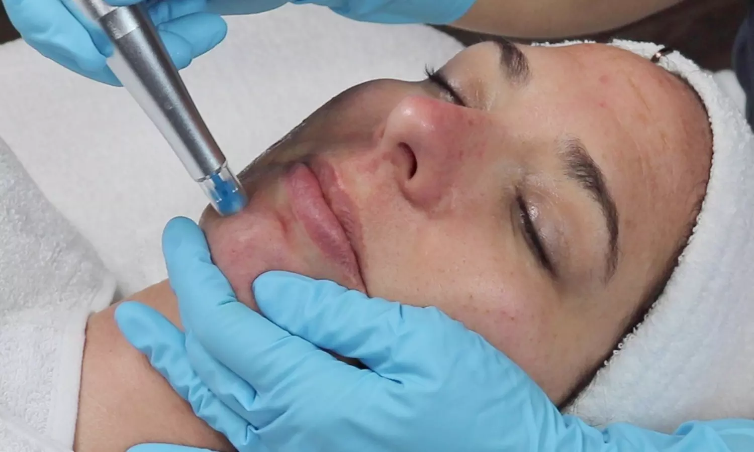 Utopia Skincare offers facials including Back, Deep Cleanse, Rezenerate & more with up to 27% off for tailored skincare.