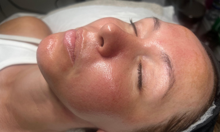Image 1: Relax with a 60-Min Deep Cleanse Facial or Bye Peach Dermaplane Facial