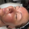 Image 1: Relax with a 60-Min Deep Cleanse Facial or Bye Peach Dermaplane Facial