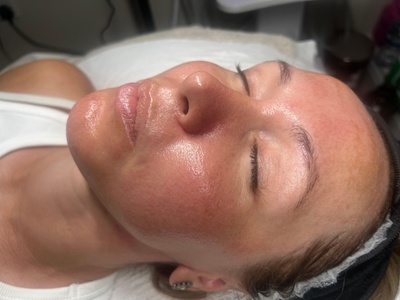 One 60 Minute relaxing deep cleanse facial - RefreshSkinTherapy