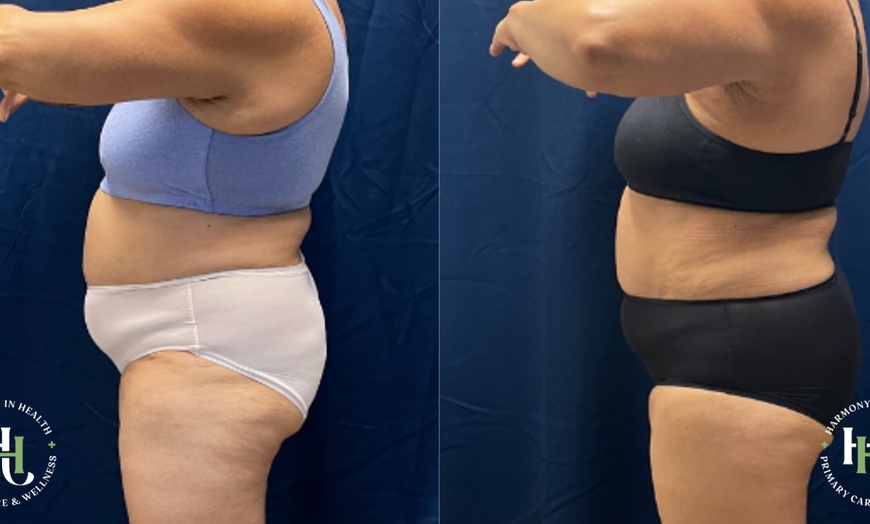 Image 9: Get EM Sculpt Abs/Buttocks/Thighs in Just 30 Minutes at Harmony In Health (Up to 74% Off)