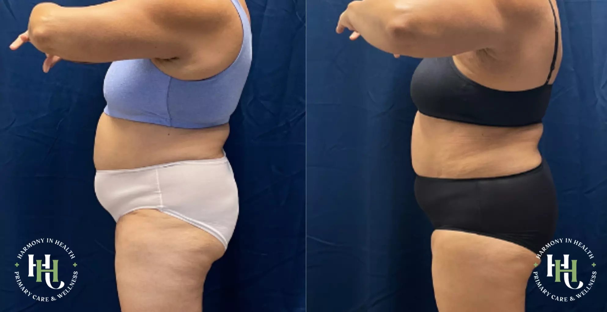 Get EMS Sculpt Abs/Buttocks/Thighs in Just 30 Minutes (Up to 74% Off)