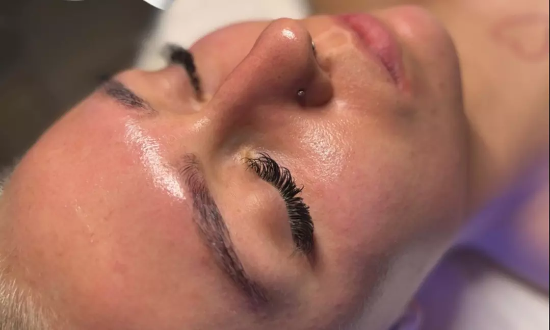 Enhance Your Glow with 1, 2, or 3 Chemical Peels