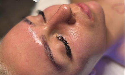 1 Chemical Peel (45 min) - Skingurucat