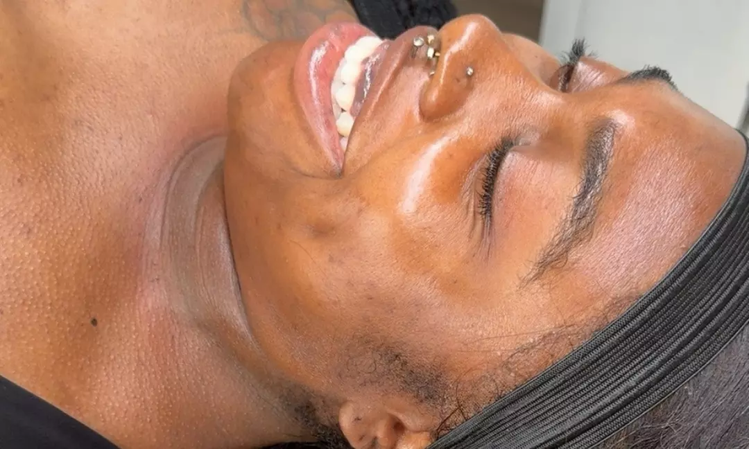 Up to 54% Off on Micro-Needling at Embodied by Barbie - Primary Image
