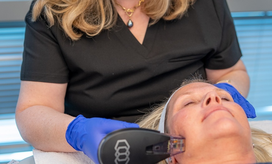 Image 6: Get Radiant Skin with 1, 2, or 3 IPL Sessions - 10 Minutes Per Session