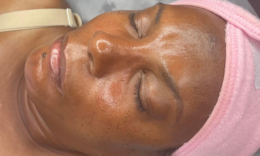 Image 1: Up to 58% Off on Facelift - Non-Surgical at Clinical Complexions Llc