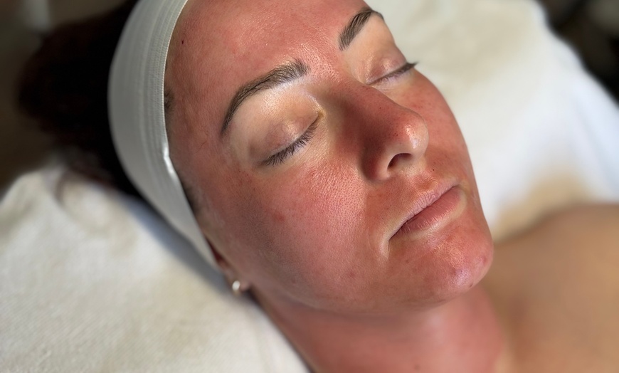 Image 7: Up to 35% Off on  at Dermatone Skincare Studio
