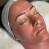 Image 7: Up to 35% Off on  at Dermatone Skincare Studio