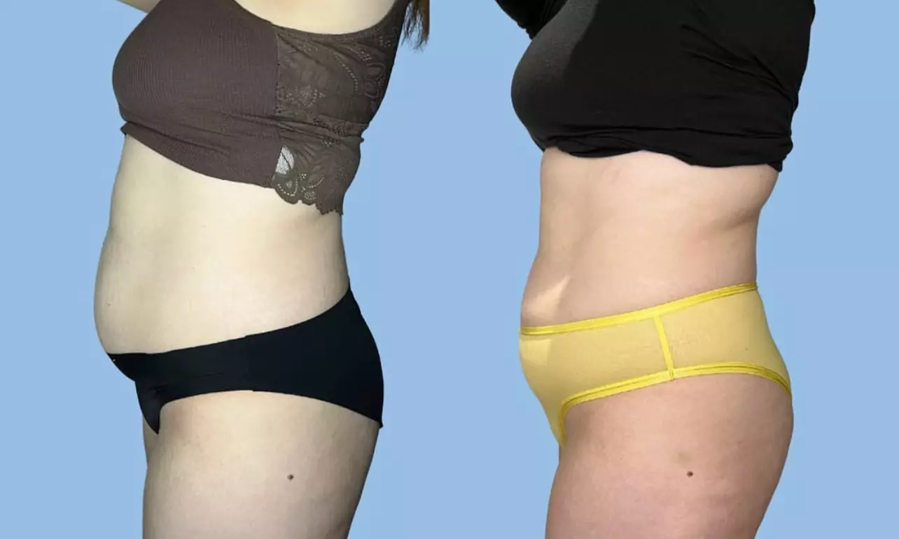 Up to 44% Off on Electrical Muscle Stimulation at Body Sculpt by Celine - Second Medium