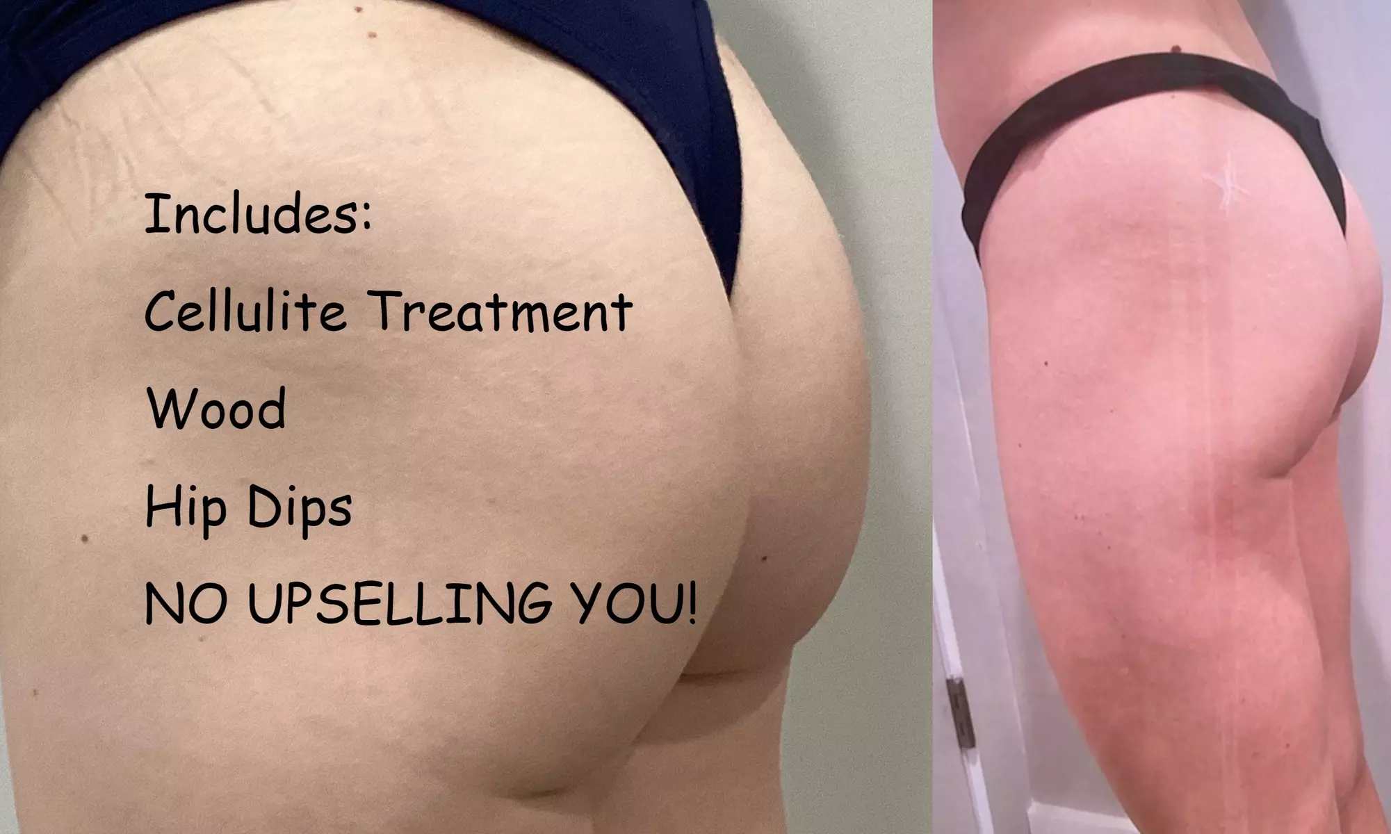 Up to 61% Off on Non-Surgical Butt Lift at Cryo Curves - Primary Image