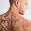 Image 2: 1 or 2 Sessions of Laser Tattoo Removal on Area Up to 5cm and More