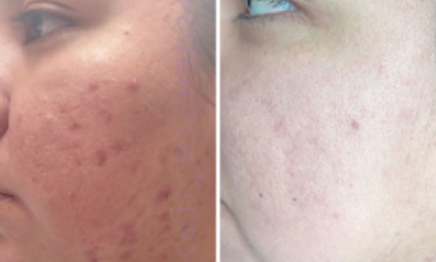 Image 8: Relaxing Facial & Massage or Holistic Body Contour & Wrap Treatment