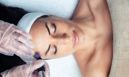 One Microneedling Revitalise and Rejuvenate Session