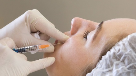 One Lip Flip - up to 15 Units of Botox® - Luna Vision and Medspa