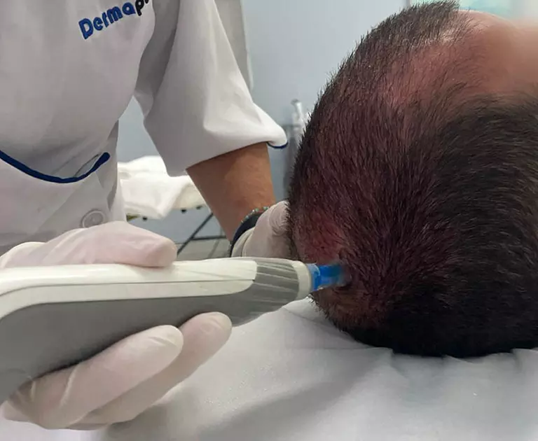 Up to 67% Off on Salon - Hair Straightening Treatment at UK Aesthetics Lounge